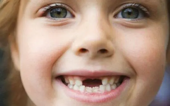 梦见掉牙是什么意思? 梦见掉牙的五种解释