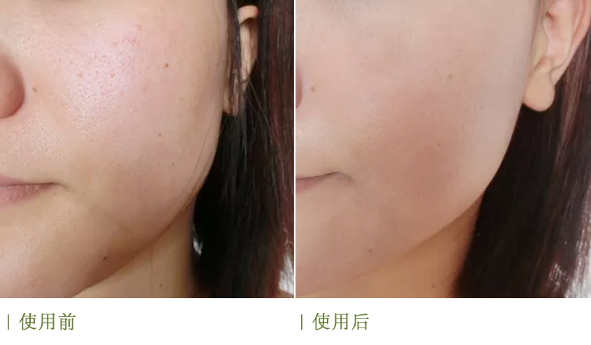 海蓝之谜精粹水好用吗(LaMer精萃水的作用和功效) 海蓝之谜精粹水好用吗(LaMer精萃水的作用和功效)